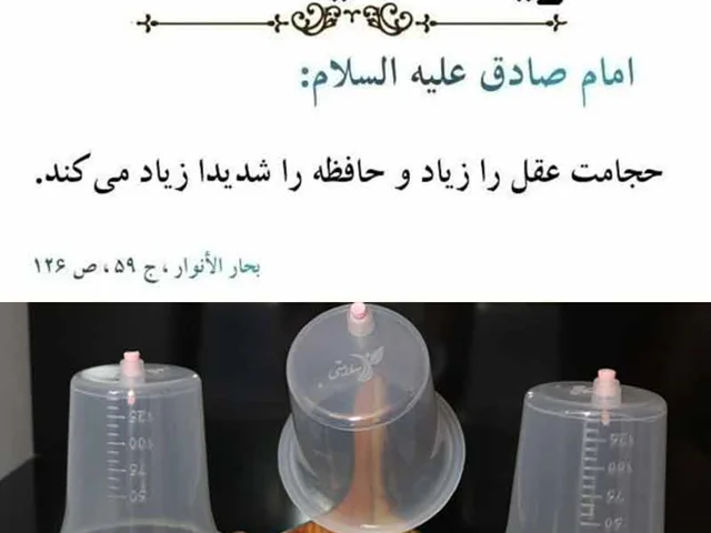 بهترین زمان حجامت