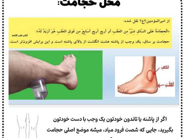 حجامت ساقین فواید و موارد برای کنترل بیماری ها:
