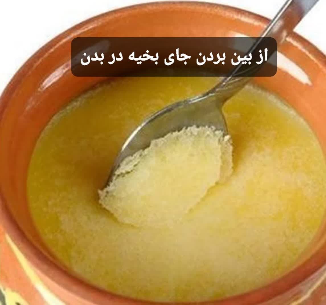 چطور جای بخیه رااز بین ببریم ؟